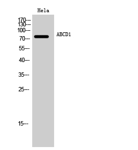 ABCD1 Polyclonal Antibody