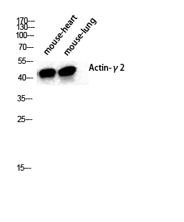 Actin α3 Polyclonal Antibody