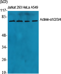 Actinin-α1/2/3/4 Polyclonal Antibody