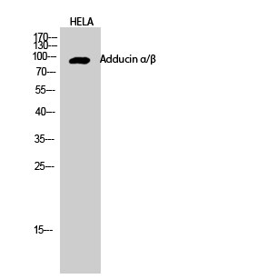 Adducin α/β Polyclonal Antibody