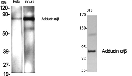 Adducin α/β Polyclonal Antibody