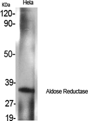 Aldose Reductase Polyclonal Antibody