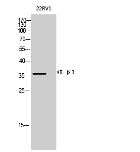 AR-β3 Polyclonal Antibody