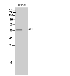 AT1 Polyclonal Antibody