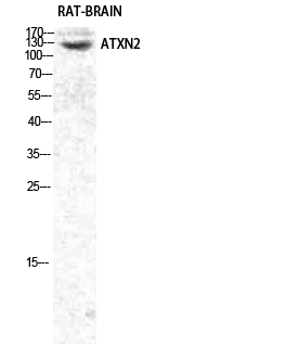 Ataxin-2 Polyclonal Antibody