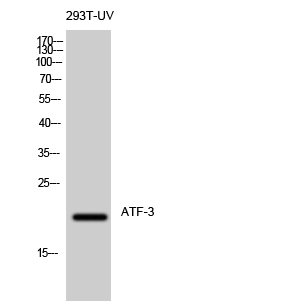 ATF-3 Polyclonal Antibody