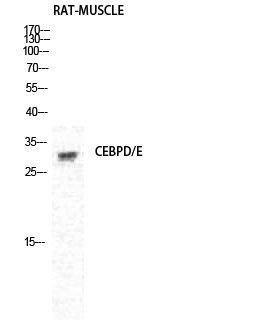 C/EBP δ/ε Polyclonal Antibody