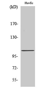 CCP2 Polyclonal Antibody