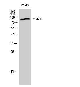 cGKII Polyclonal Antibody