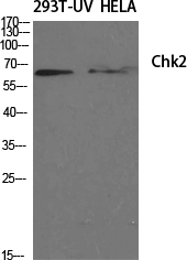 Chk2 Polyclonal Antibody