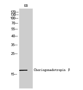 Choriogonadotropin β Polyclonal Antibody