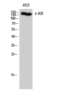 c-Kit Polyclonal Antibody