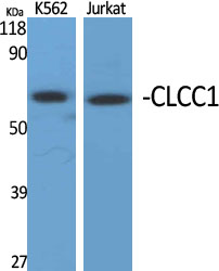 CLCC1 Polyclonal Antibody