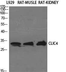 CLIC4 Polyclonal Antibody