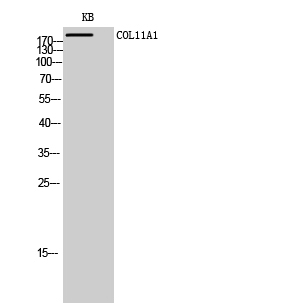 COL11A1 Polyclonal Antibody