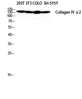 COL4A2 Polyclonal Antibody