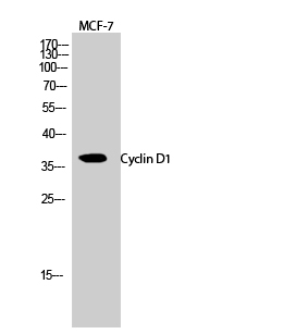 Cyclin D1 Polyclonal Antibody