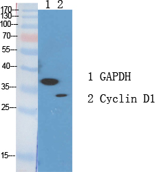 Cyclin D1 Polyclonal Antibody