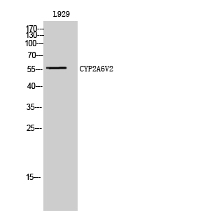 CYP2A6V2 Polyclonal Antibody