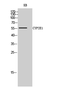 CYP2E1 Polyclonal Antibody