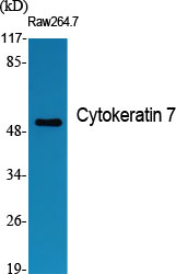 Cytokeratin 7 Polyclonal Antibody