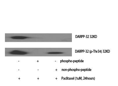 DARPP-32 Polyclonal Antibody