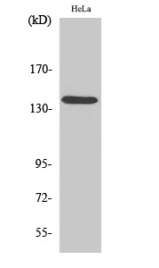 DDX8 Polyclonal Antibody