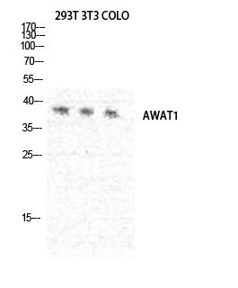 DGAT2L3 Polyclonal Antibody