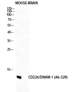 DNAM-1 Polyclonal Antibody