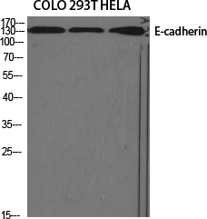 E-cadherin Polyclonal Antibody