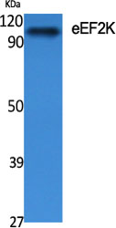 eEF2K Polyclonal Antibody