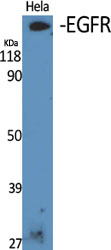 EGFR Polyclonal Antibody