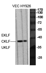 EKLF/CKLF/UKLF Polyclonal Antibody