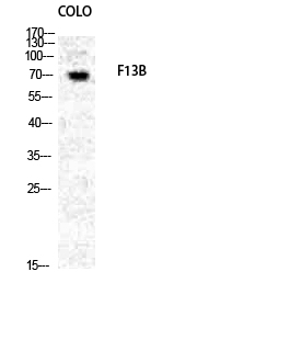 Factor XIII B Polyclonal Antibody - SAB | Signalway Antibody