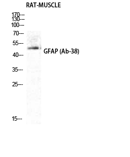 GFAP Polyclonal Antibody