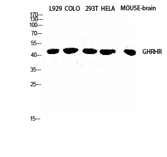 GHRH-R Polyclonal Antibody