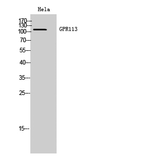 GPR113 Polyclonal Antibody