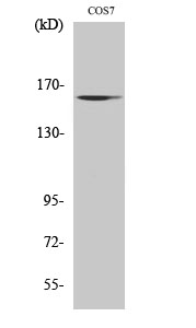 GTBP Polyclonal Antibody