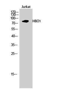 HBO1 Polyclonal Antibody