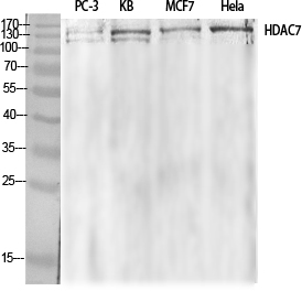 HDAC7 Polyclonal Antibody