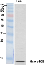 Histone H2B Polyclonal Antibody