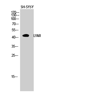 LYAR Polyclonal Antibody