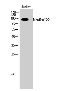 NFκB-p100 Polyclonal Antibody