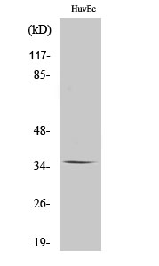 Olfactory receptor 11G2 Polyclonal Antibody