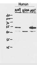 p53 Polyclonal Antibody