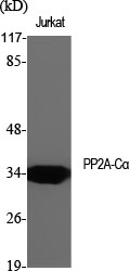 PP2A-Cα Polyclonal Antibody