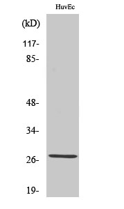 PP32R1 Polyclonal Antibody