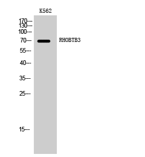 RHOBTB3 Polyclonal Antibody