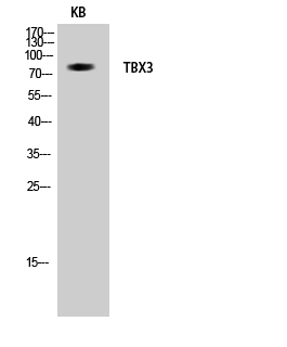 TBX3 Polyclonal Antibody