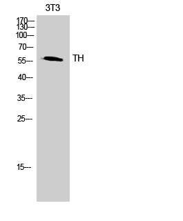 TH Polyclonal Antibody